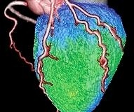 kalp koroner yedekleme