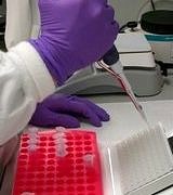 Kimlerin kemoterapiden yararlanabileceğini gösteren gen seti