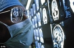 Kanser tedavisinde yeni hedef: P53 gen aktivasyonu