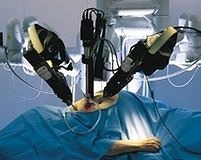 Robotik cerrahi komplikasyonları azaltabilir