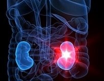 Böbrek kanserinde yeni nesil tedavi: Votrient