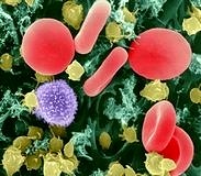 IL-1β aktivasyonu vücudu saldırılardan koruyabilir