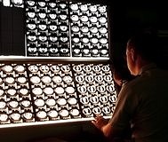 Radyasyon çalışanlarının icap nöbetleri çalışma süresinden düşülecek