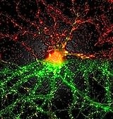 Alzheimera neden olan mekanizma çözülüyor