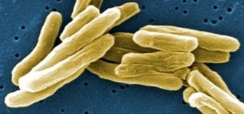 Çocuklarda tüberkülozunun tanısı ve tedavisi