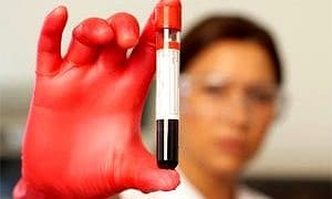 Türkiye’de kordon kanının %97’si çöpe gidiyor