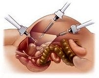 Prof. Dr. Şendağ: Açık cerrahi yakında tarih olacak!
