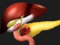 Pankreas kanserine karşı yeni bir tedavi yöntemi geliştirildi