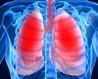 MetMAb artı erlotinib kombinasyonu sağkalımı önemli oranda arttırdı