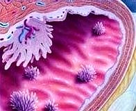 FDA, Pioglitazon ve mesane kanseri ilişkisi için uyardı