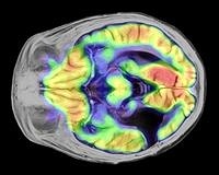 Birleşen MR ve PET teknolojisi, bedeni görünür kıldı