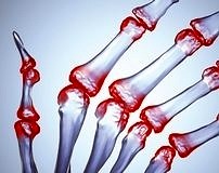 Tosilizumab’a Prix Galien Fransa Ödülü verildi