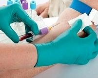 Akciğer kanserine karşı etkili yeni bir kan testi geliyor