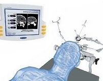 Tam zamanlı MR, beyin cerrahisinde başarıyı arttırıyor