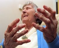 romatoid_artrit_hasta