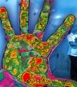 Tıp öğrencilerinin çoğunluğu temel hijyeni bilmiyor