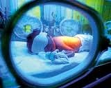 Erken doğan bebeklerde körlük riskine dikkat!