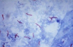 mycobacterium_tuberculosis
