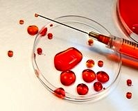 Kan testiyle erken evrede parkinson teşhisi artık mümkün!