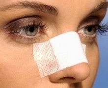 burun-estetigi-kapak