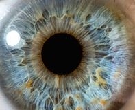 Körlüklerin yüzde 80’i önlenebilir