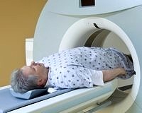 Nöroendokrin prostat kanserlerinde yeni tedavi olasılığı