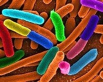 Yeni strateji: Bakterilerle savaşmak yerine uzlaşmak