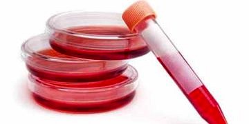 Hepatit B’de tedavi uyumu ve devamlılığı