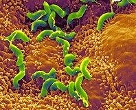 Her yıl 19 milyon kişiye Helikobakter reçetesi yazılıyor