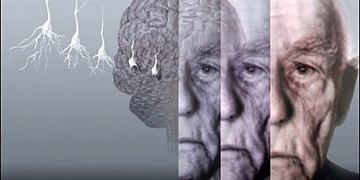 Her demanslı kişi Alzheimer hastası değildir! Farklar ve benzerlikler
