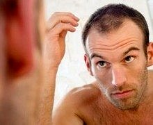 hair-loss-men