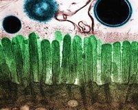 Alerjiye karşı yeni bir tedavi stratejisi: Gut bakterisi!