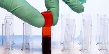 Meme kanseri teşhisinde basit ve etkili yeni bir kan testi