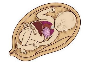 Doğumsal karın duvarı defektleri tanı ve tedavisi