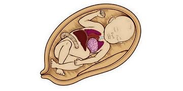 Doğumsal karın duvarı defektleri tanı ve tedavisi