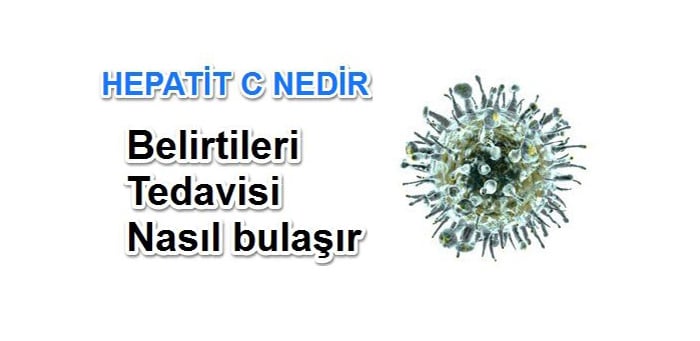 Hepatit C Nedir Nasil Bulasir Belirtileri Ve Tedavi Secenekleri