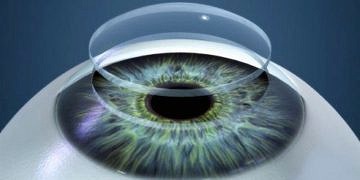 Kornea hastalıkları tanı ve tedavisi