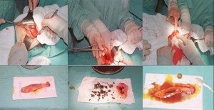 splenektomi-tedavisi