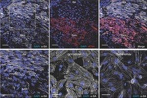 kalp-hucresi-peacemaker