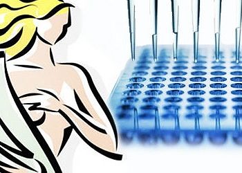 Biyolojik markırlar meme kanseri ilaçlarının başarısını artırıyor