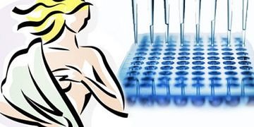 Biyolojik markırlar meme kanseri ilaçlarının başarısını artırıyor