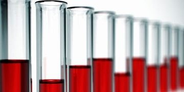 Miyelodisplastik Sendrom (MDS)