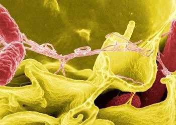 Salmonella enfeksiyonları tanı ve tedavisi