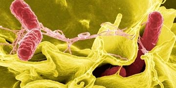 Salmonella enfeksiyonları tanı ve tedavisi