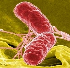 Salmonella enfeksiyonları tanı ve tedavisi