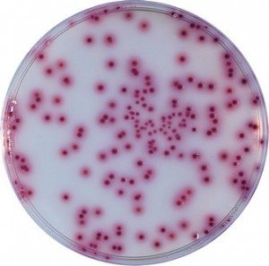 malmonella-enfeksiyon-bakteri