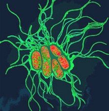 salmonella-ekoli-enfeksiyon-bakteri