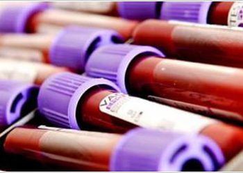 Adli toksikoloji açısından kaza, zehirlenme, intihar ve cinayet analizi