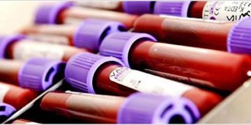 Adli toksikoloji açısından kaza, zehirlenme, intihar ve cinayet analizi