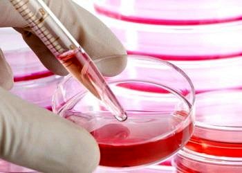 İyileşmeyen yaralara karşı kök hücre tedavisi ne kadar başarılı